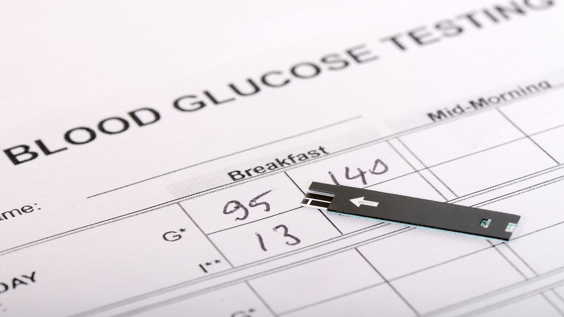 Các loại xét nghiệm glucose trong máu bạn cần biết