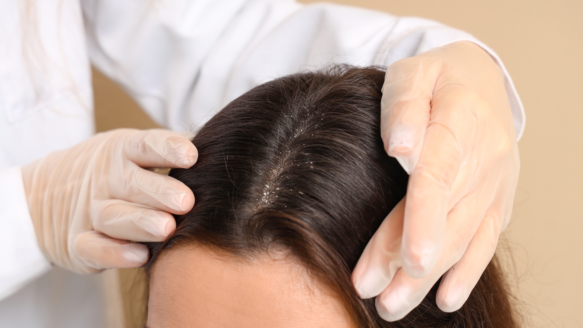 Những người đang gặp các bệnh lý da đầu nên thận trọng khi sử dụng chanh