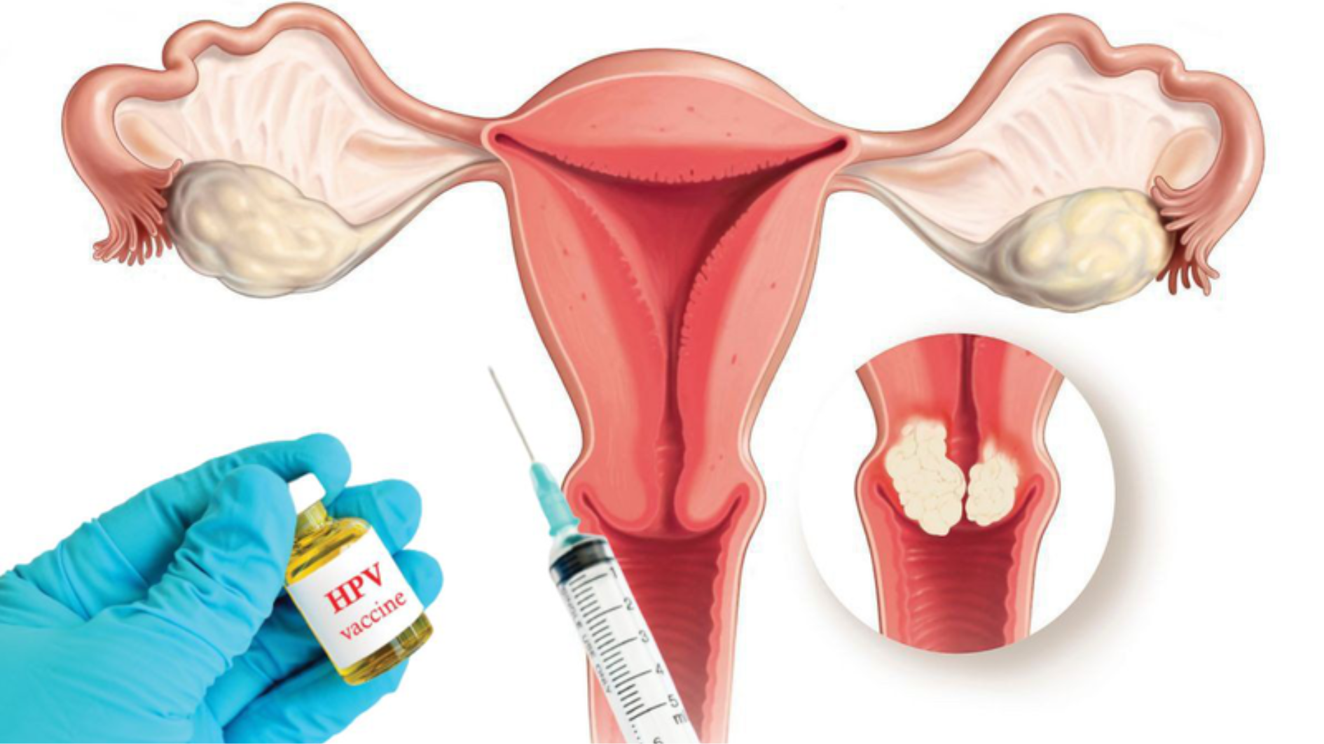 goi-y-dia-chi-tiem-hpv-o-quang-tri-uy-tin-an-toan-muc-gia-uu-dai (1).png