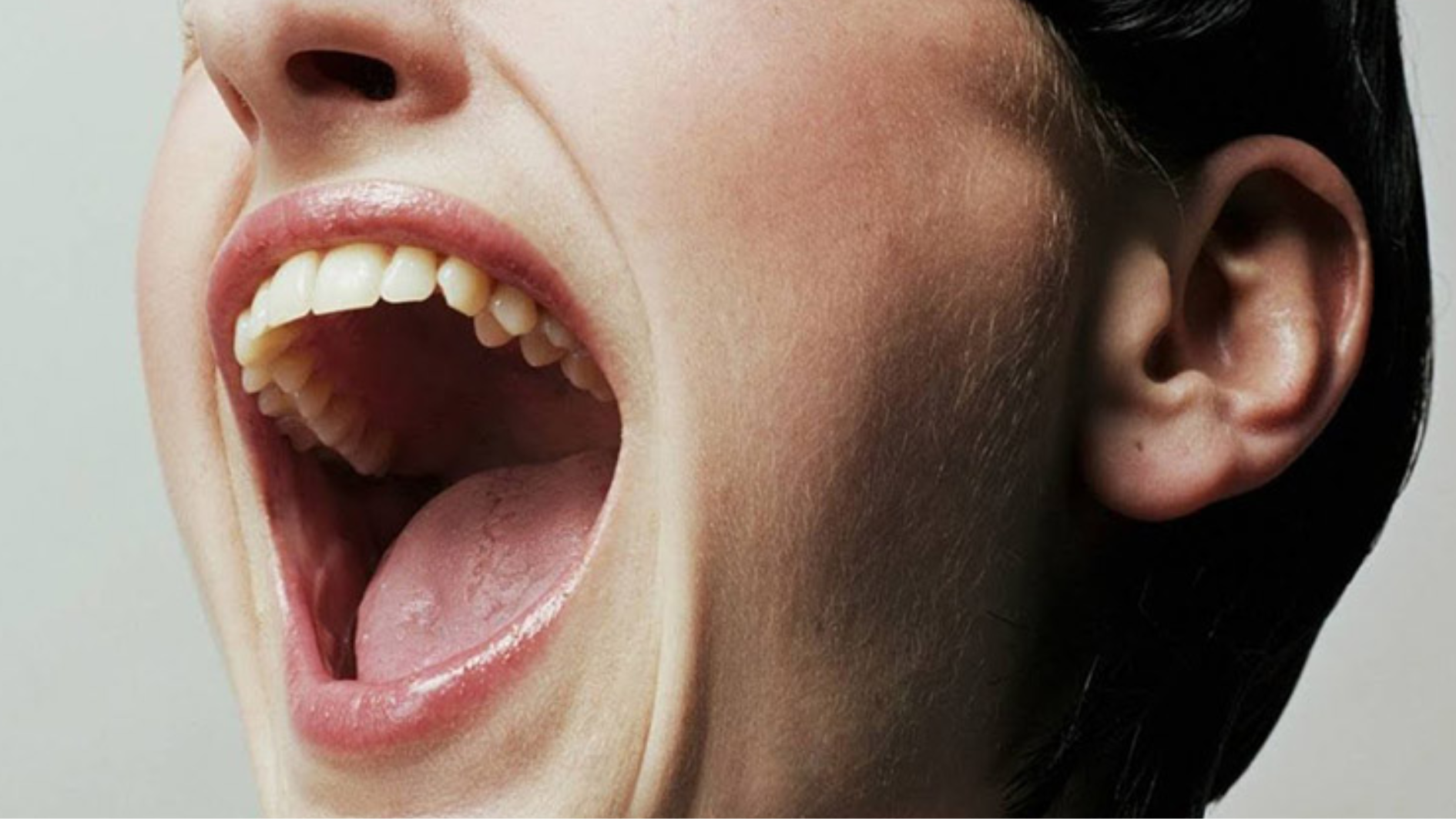 ha-mieng-ra-bi-dau-ham-dau-hieu-nguyen-nhan-va-bien-phap-khac-phuc (2).png