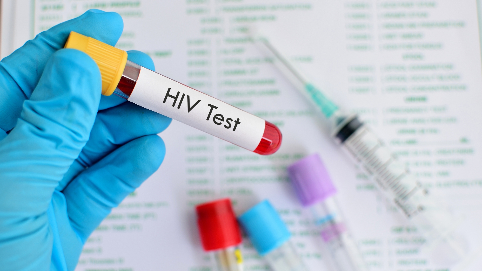 Thực hiện xét nghiệm phù hợp là bước cần thiết để phân biệt chính xác các nguyên nhân gây hạch