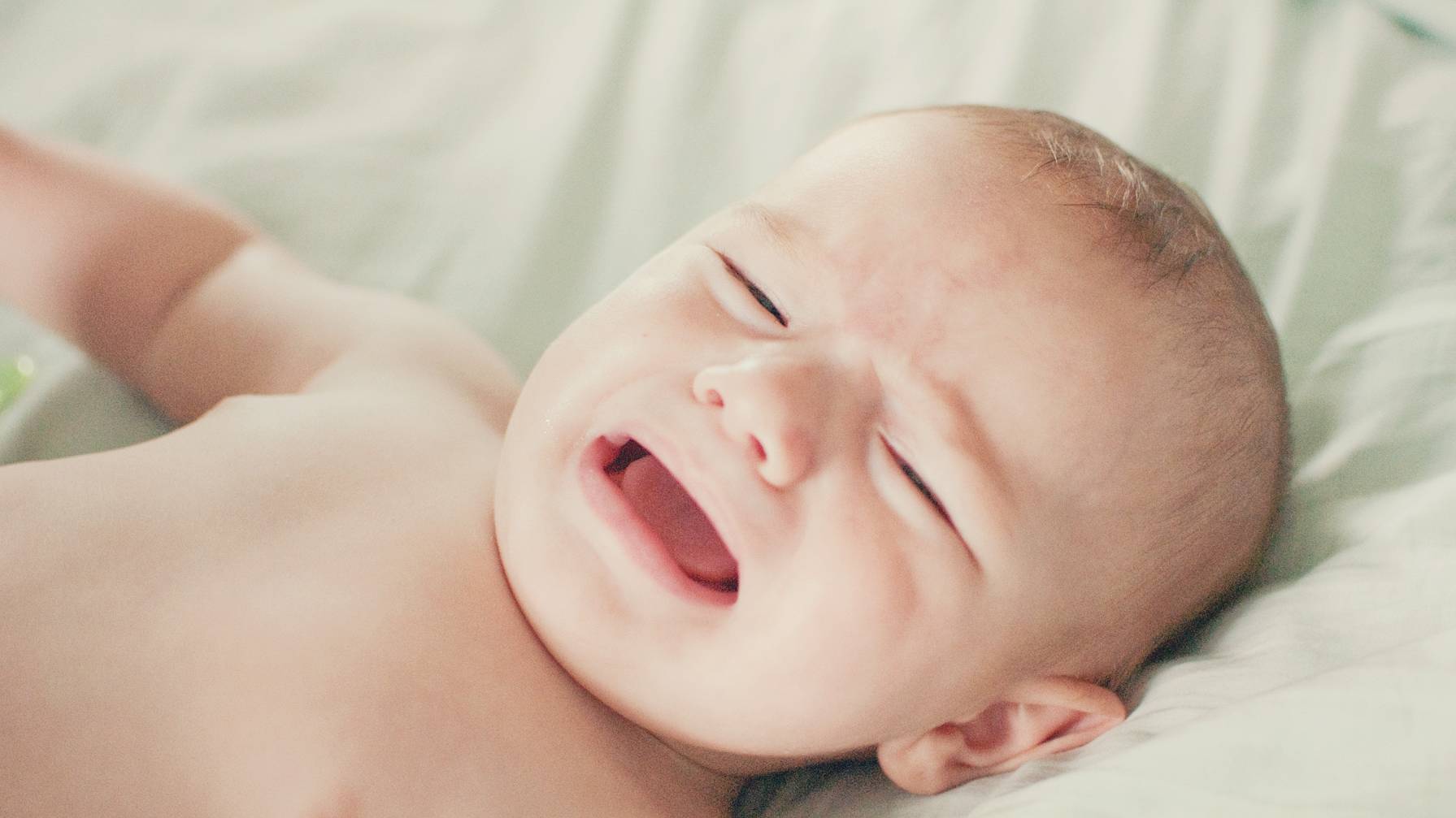 Triệu chứng hăm tã cấp độ 5 là da sưng đỏ, có mủ dễ vỡ, khiến bé đau rát, quấy khóc