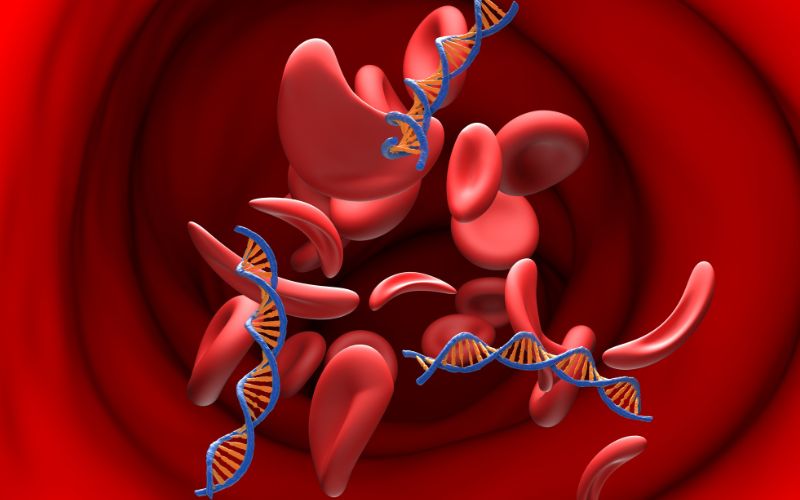 Xét nghiệm NIPT 4 cho phép phát hiện các bất thường nhiễm sắc thể thường gặp và một số rối loạn liên quan đến nhiễm sắc thể giới tính