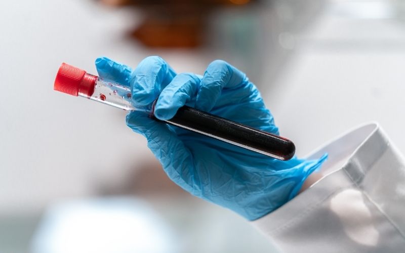 Tăng tiểu cầu là tình trạng số lượng tiểu cầu vượt quá 450000  tiểu cầu trên mỗi microlit máu