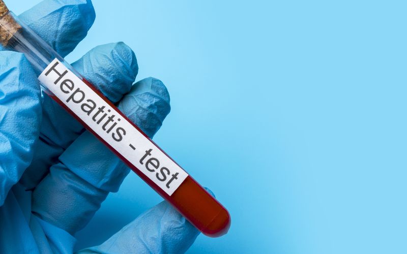 Xét nghiệm viêm gan B bao gồm xét nghiệm HBsAg, HBeAg, chức năng gan ...