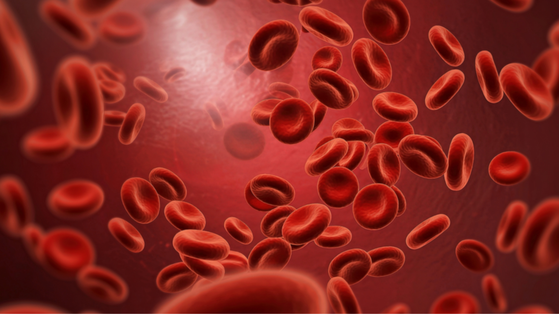 Thiếu sắt dẫn đến thiếu máu gây hoa mắt, chóng mặt