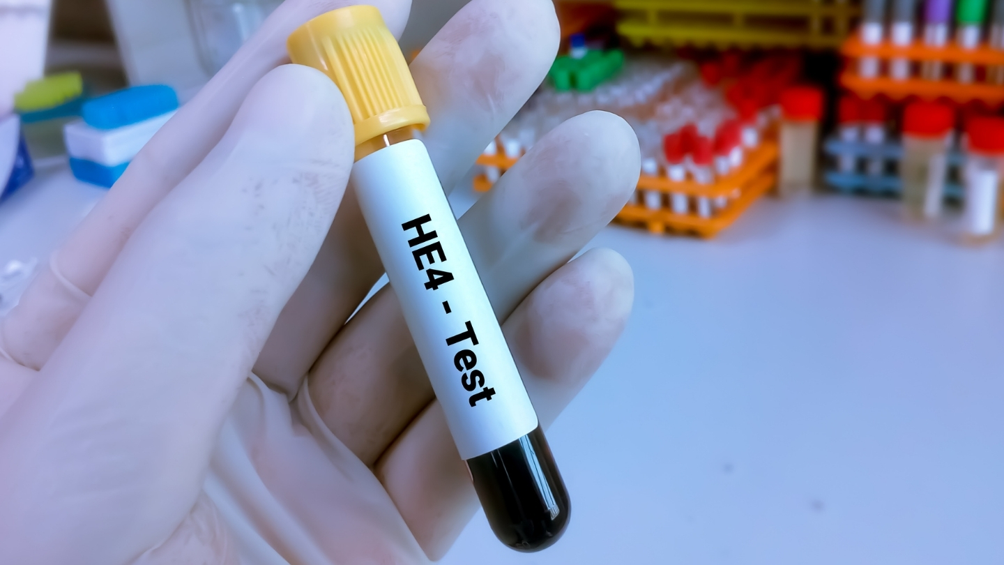 HE4 (Human Epididymis Protein 4) là một glycoprotein thuộc họ protein whey acid, được mã hóa bởi gen WFDC2