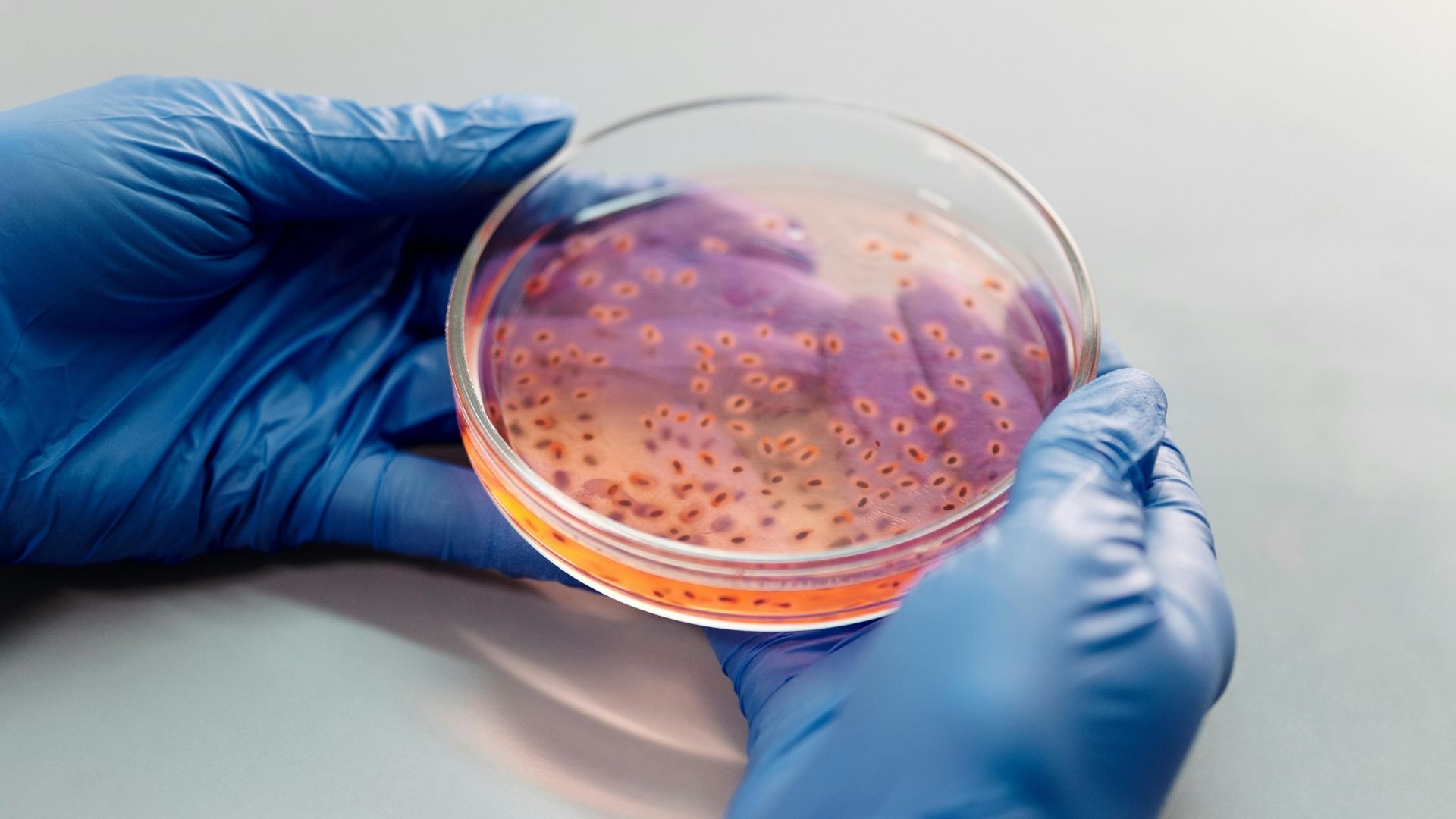 Nhiễm trùng lâu ngày có thể gây hẹp thực quản