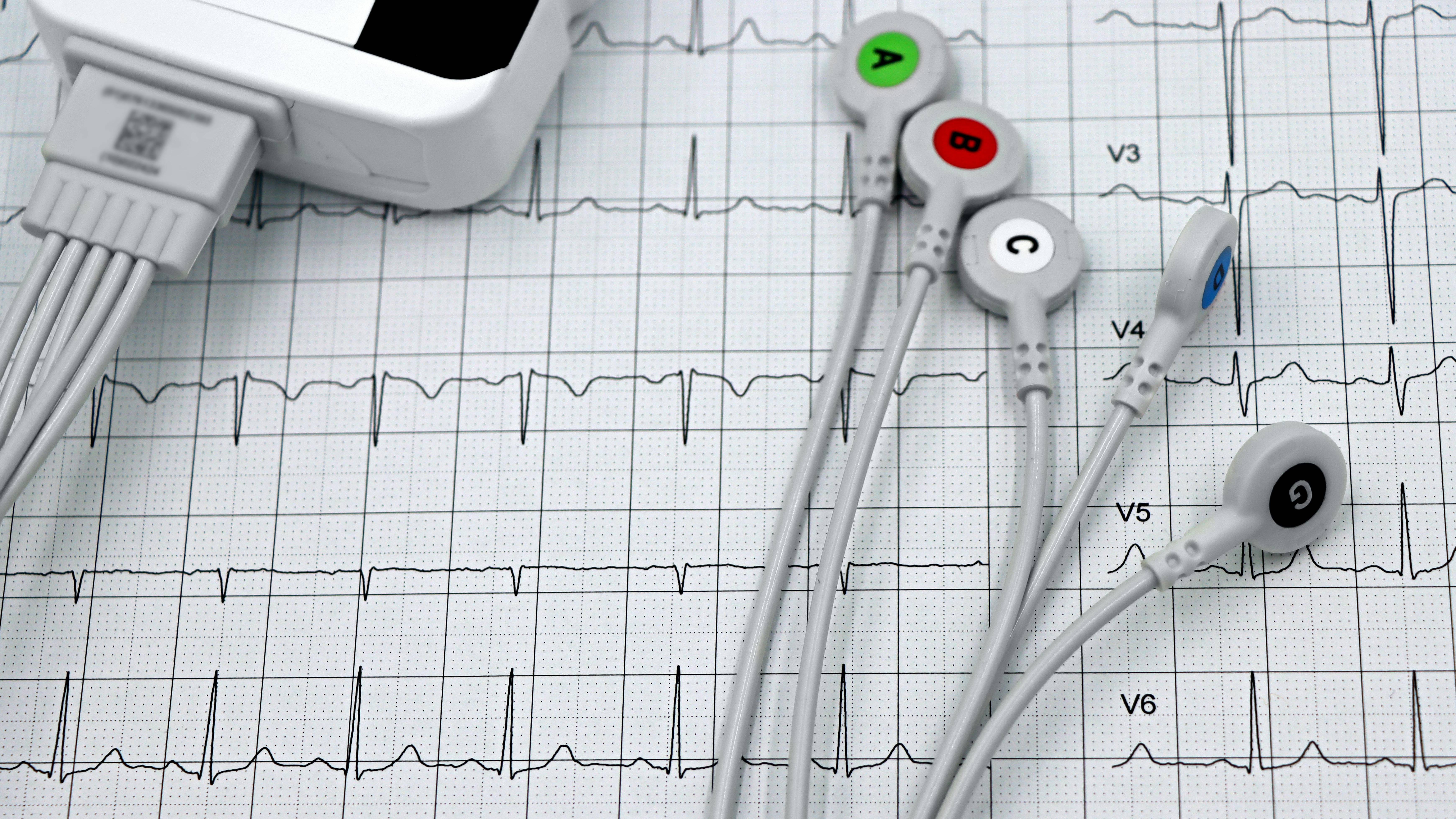 Điện tâm đồ là một trong các phương phá đánh giá chức năng tim và nguy cơ suy tim