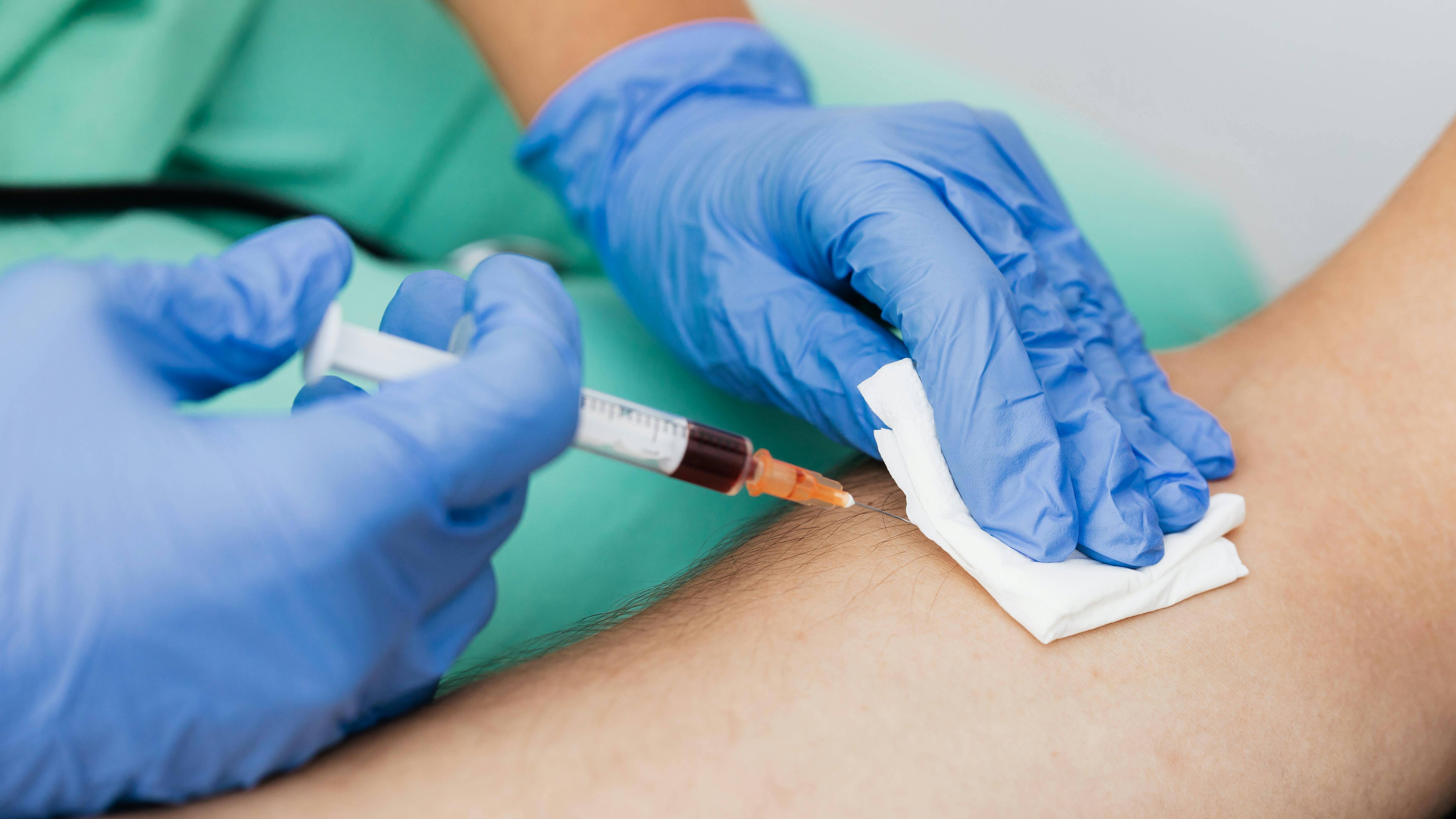 Khi xét nghiệm máu, BNP hoặc NT-proBNP tăng giúp gợi ý chẩn đoán suy tim