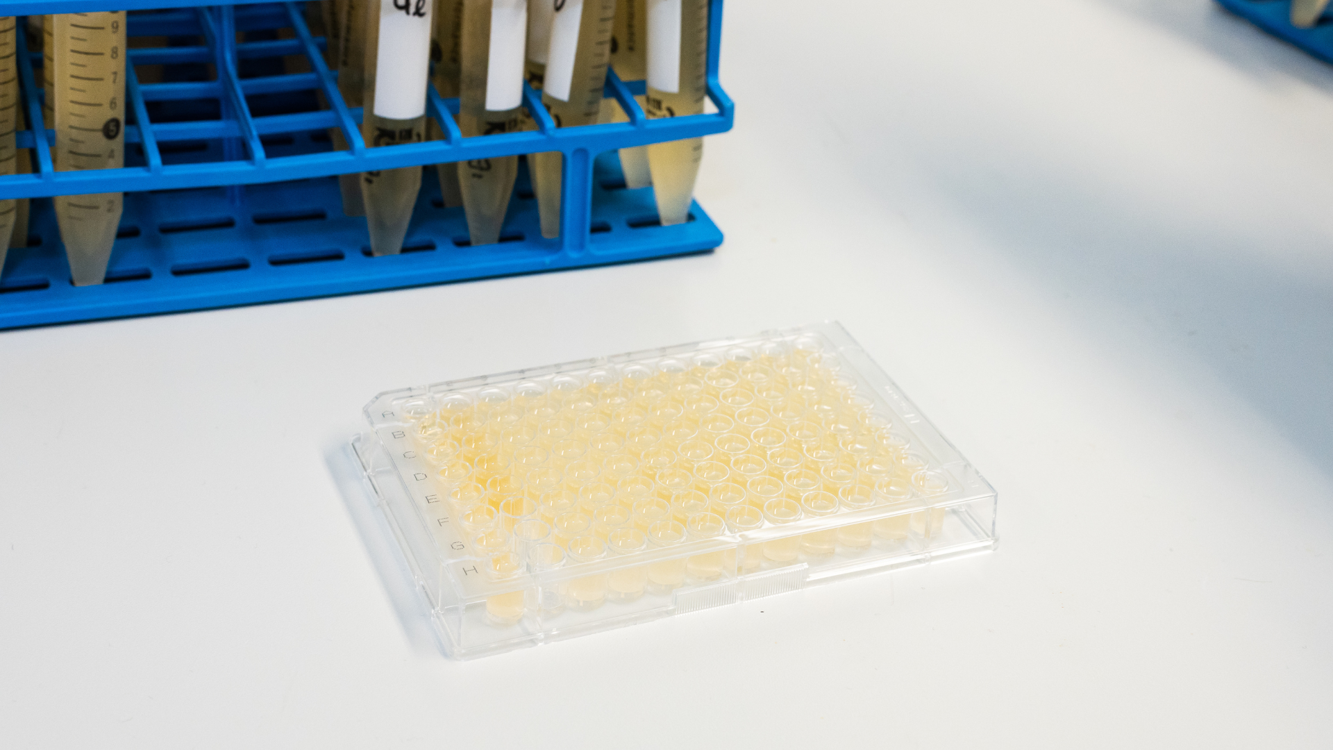 Lựa chọn thời điểm xét nghiệm phù hợp