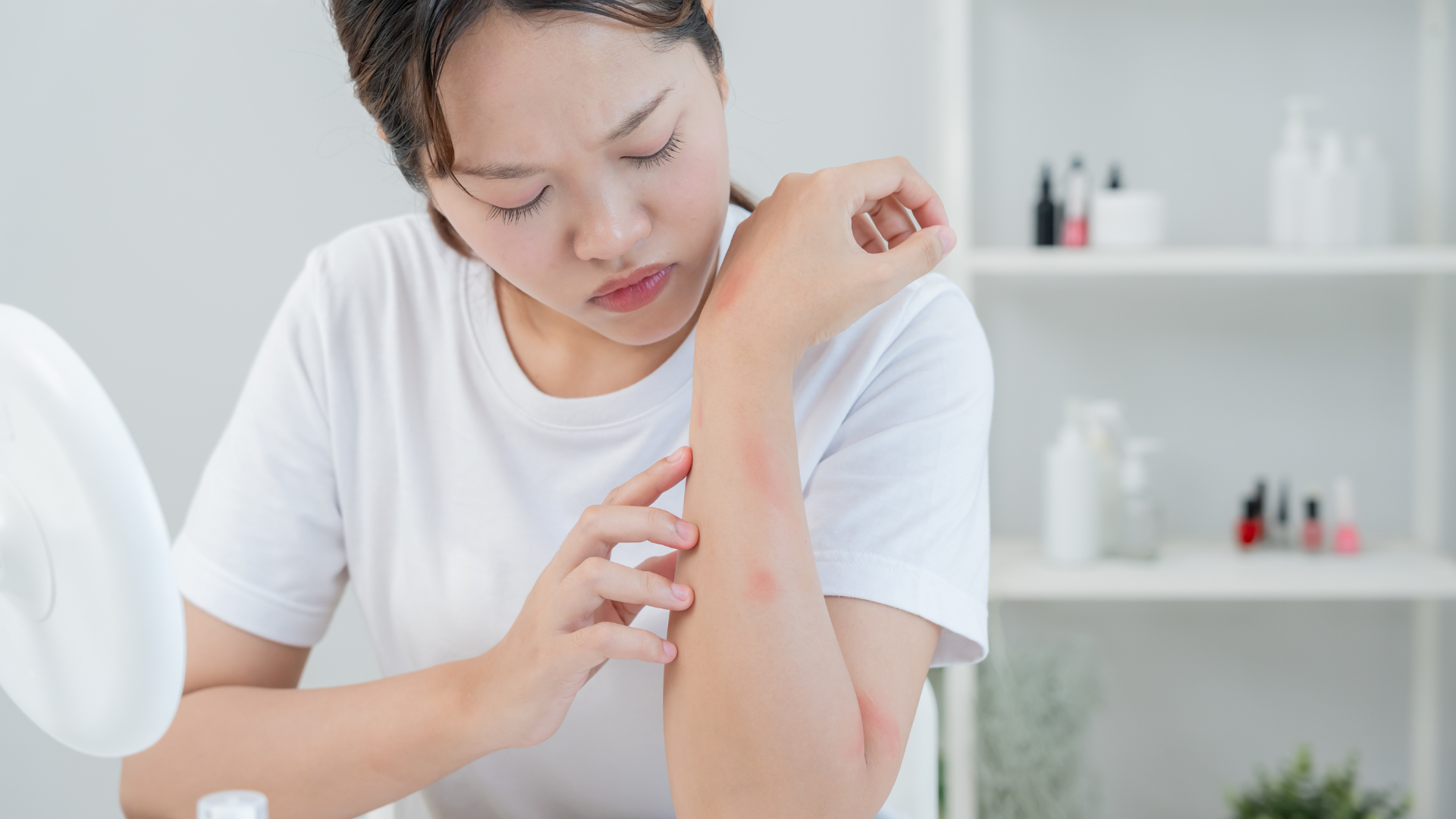 Hình ảnh bệnh viêm da mủ giúp người bệnh nhận biết sớm các tổn thương da