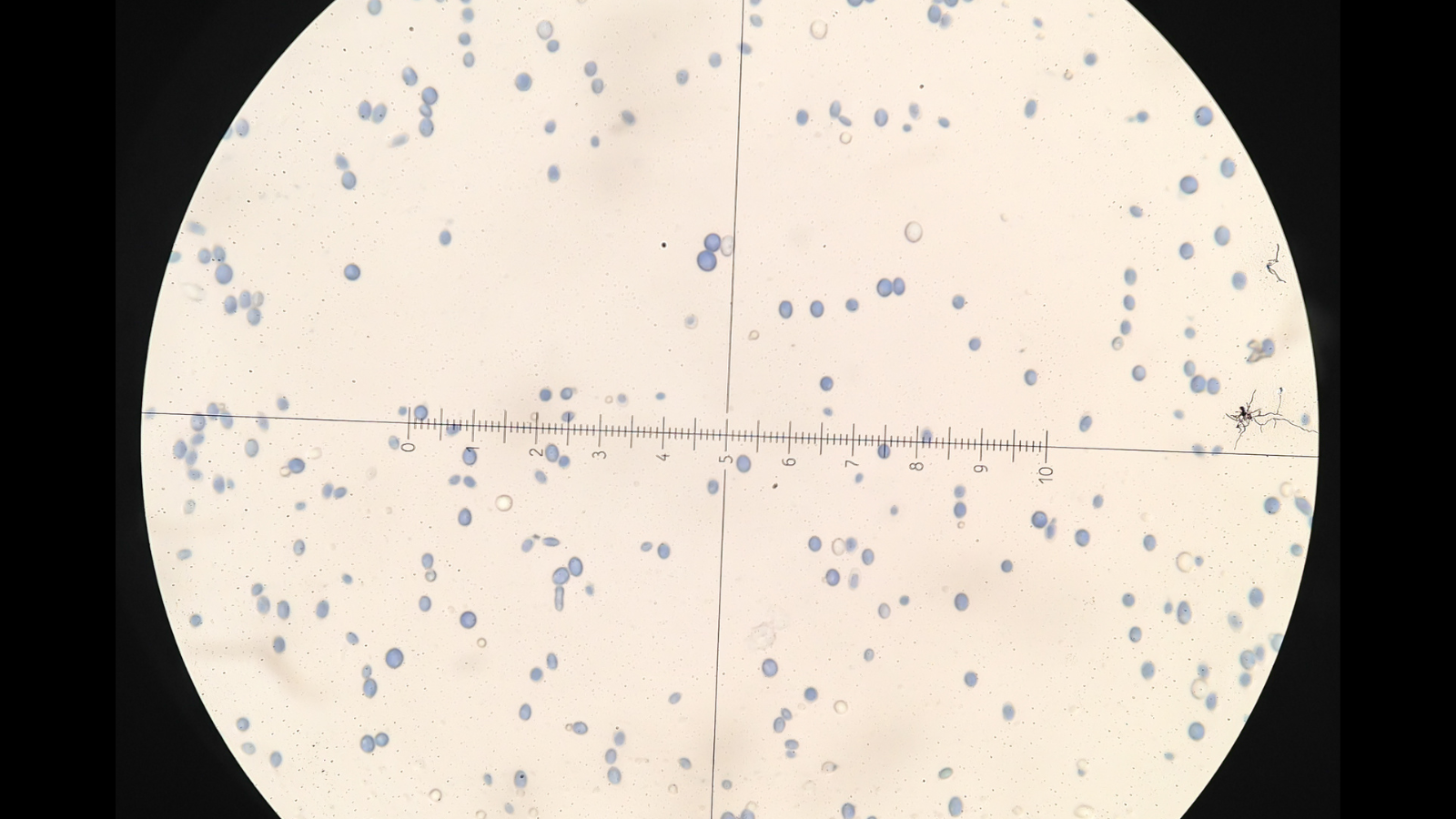 Cách nhận biết hình ảnh nấm Candida soi tươi