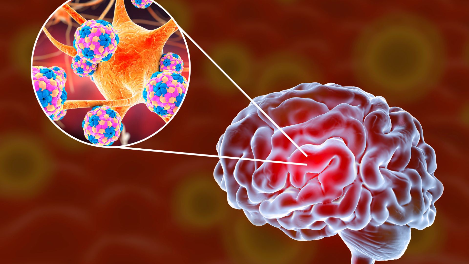 Thóp phồng có thể là dấu hiệu của bệnh viêm màng não