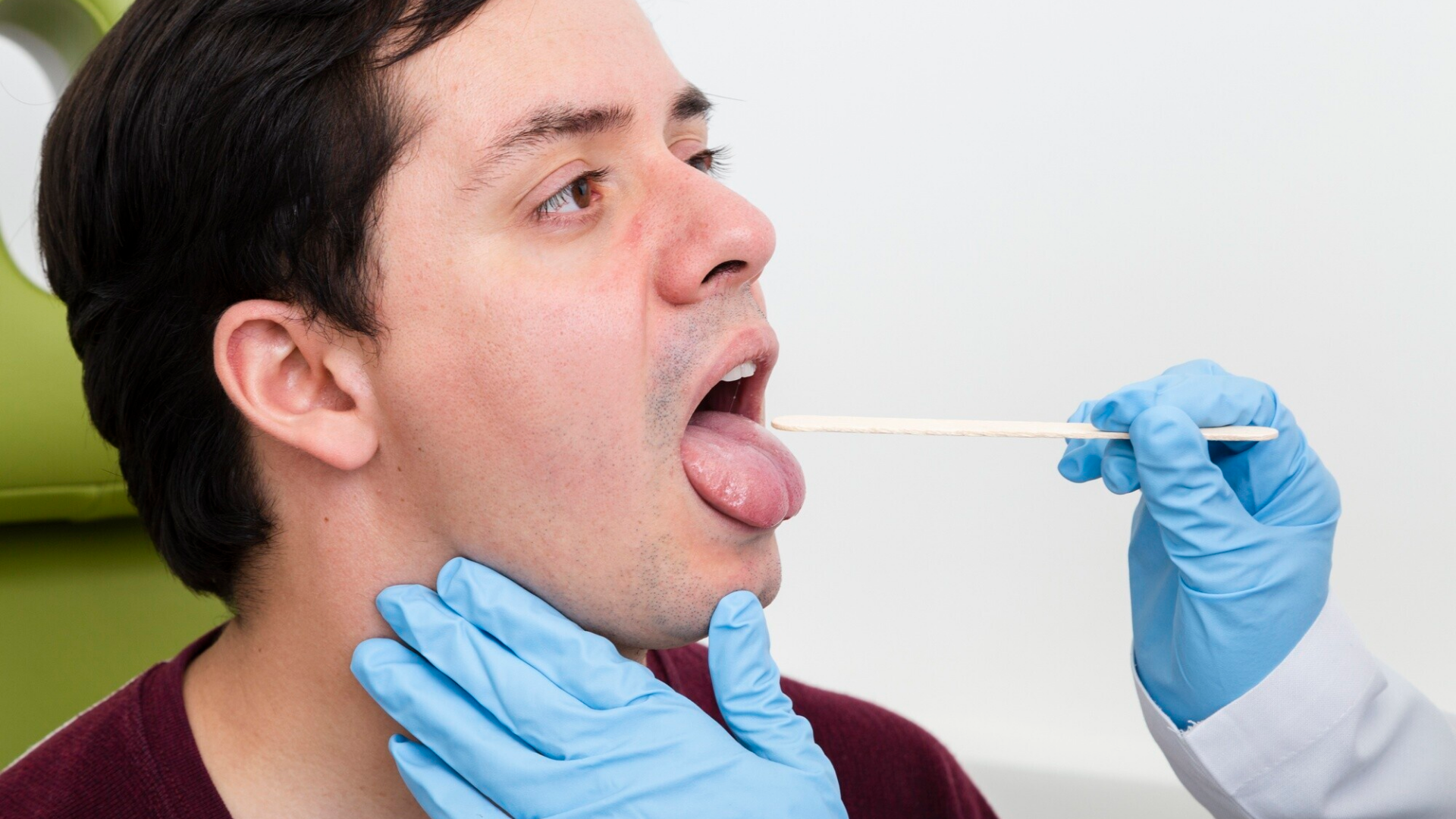 Hình ảnh viêm họng hạt trắng: Nhận biết dấu hiệu và cách xử lý hiệu quả 1