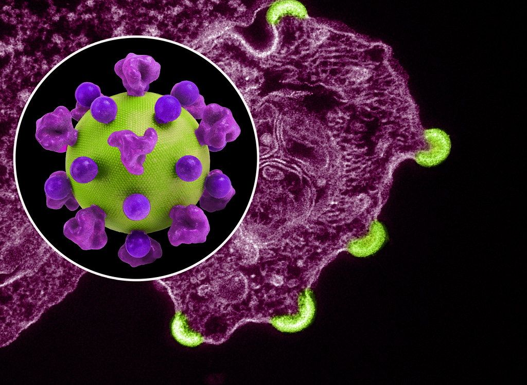 HIV có chữa được không? Những điều cần biết khi nhiễm HIV 2