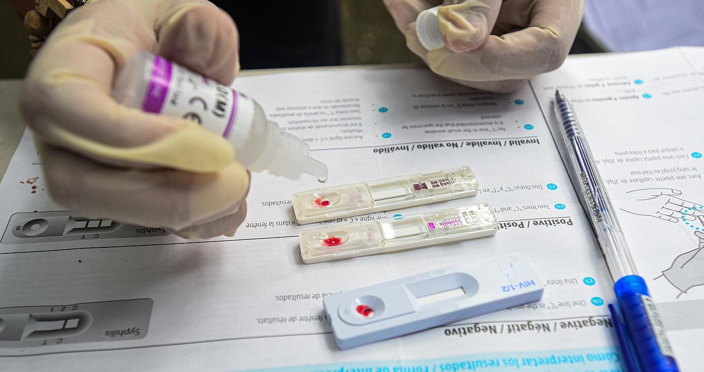HIV lây qua đường nước bọt không? 4