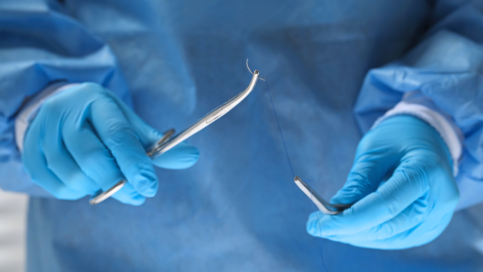 Khâu vòng cổ tử cung được chỉ định cho thai phụ bị hở eo cổ tử cung