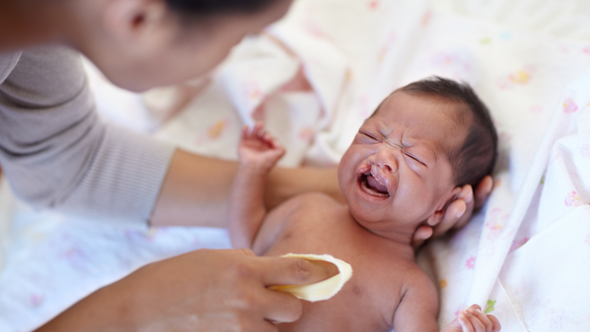 Hở hàm ếch là dị tật bẩm sinh do tác động đa yếu tố