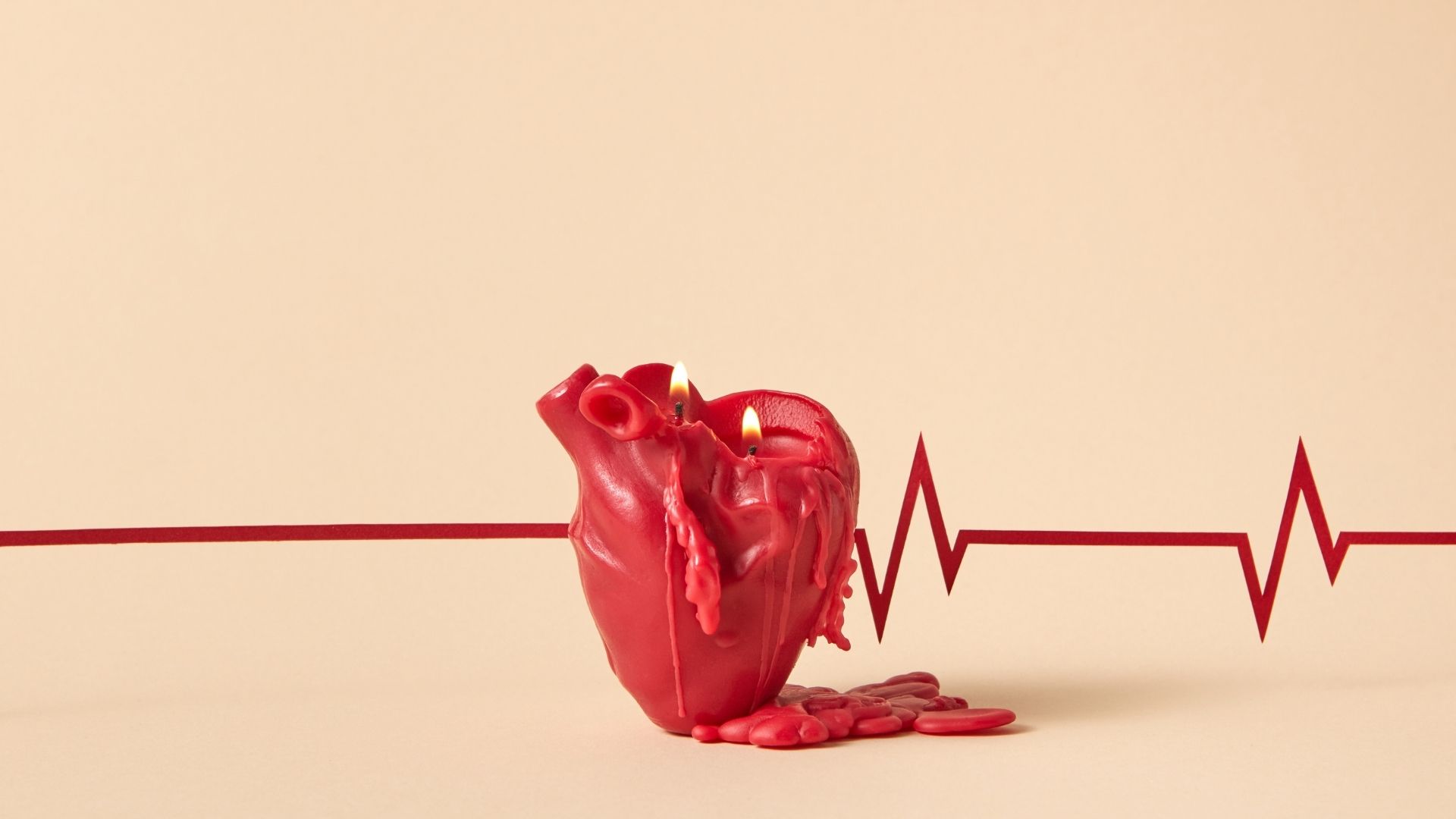 Hở van tim 2 lá có thể là di chứng nhồi máu cơ tim