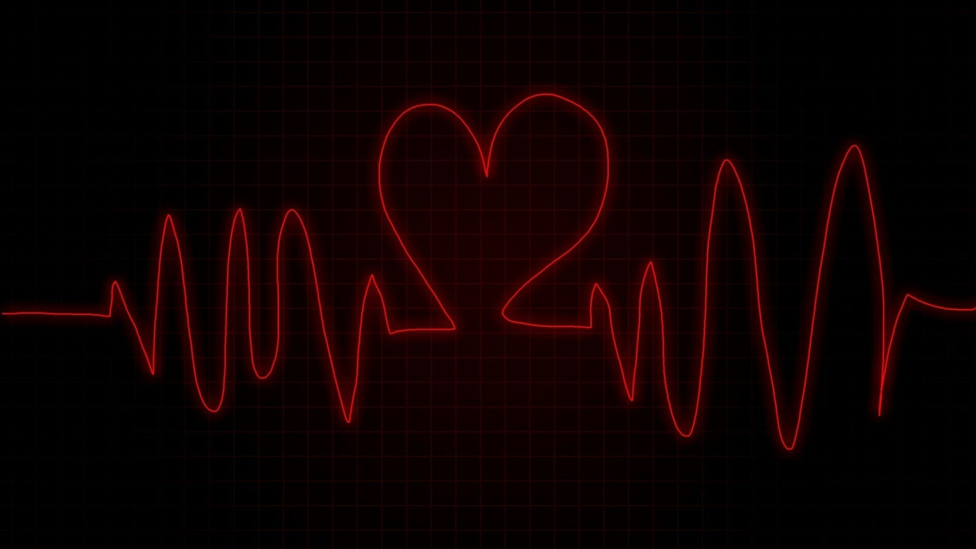 Người bị hở van tim có thể bị rối loạn nhịp tim