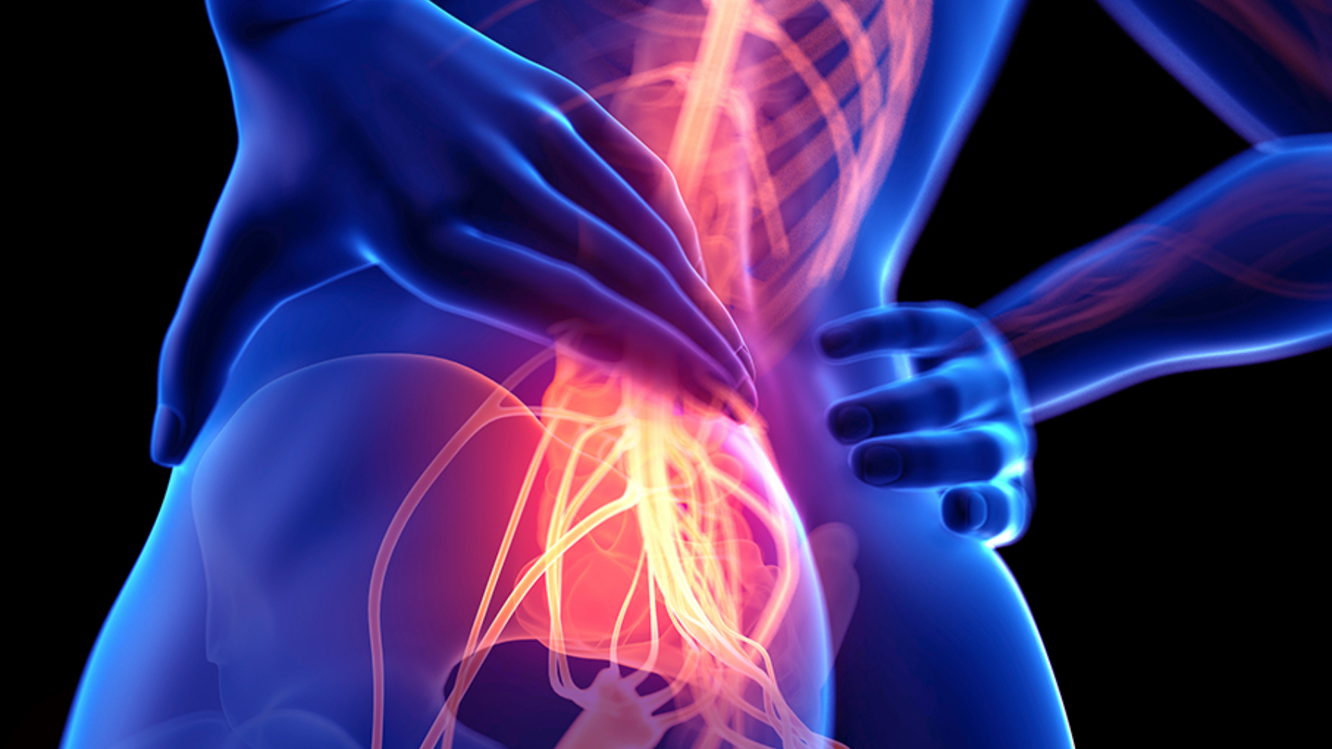 Hội chứng chùm đuôi ngựa là gì? Nguyên nhân và dấu hiệu nhận biết 1