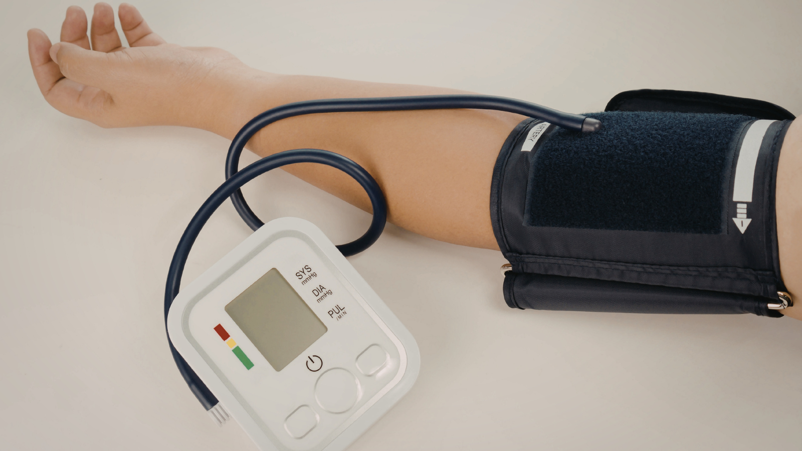 Tăng huyết áp là một trong các tiêu chuẩn chẩn đoán hội chứng chuyển hóa