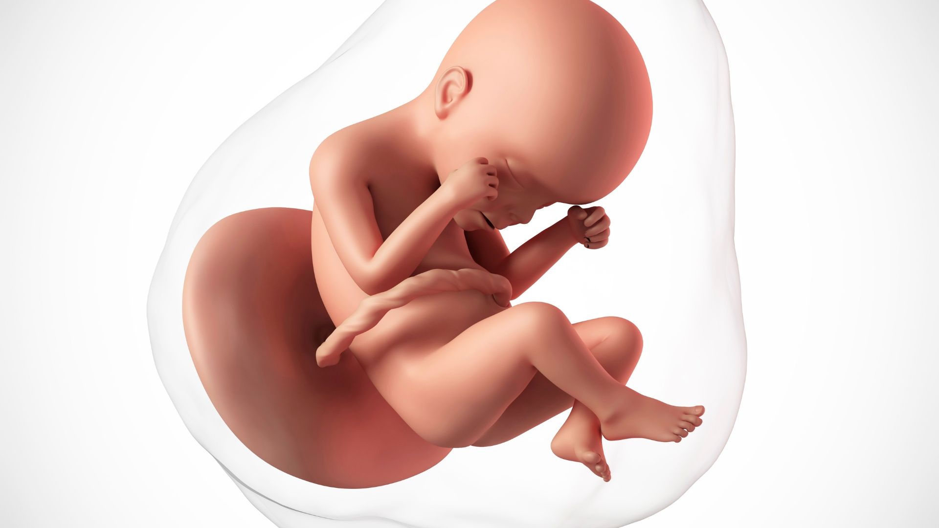 Hội chứng Edwards là gì? Nguyên nhân, dấu hiệu và tiên lượng sống 3
