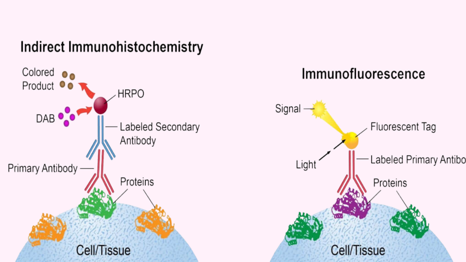 Xét nghiệm khối u giúp chẩn đoán hội chứng Lynch