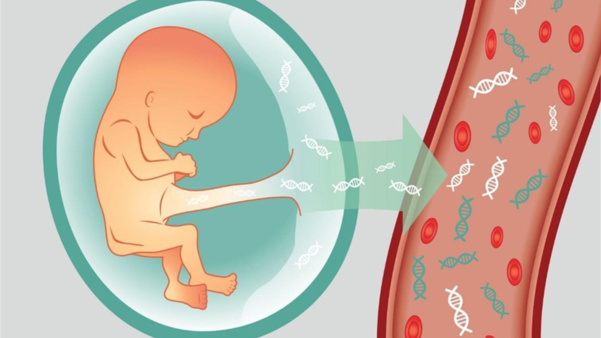 Hội chứng Patau: Nguyên nhân, dấu hiệu nhận biết và những điều thai phụ cần lưu ý 1
