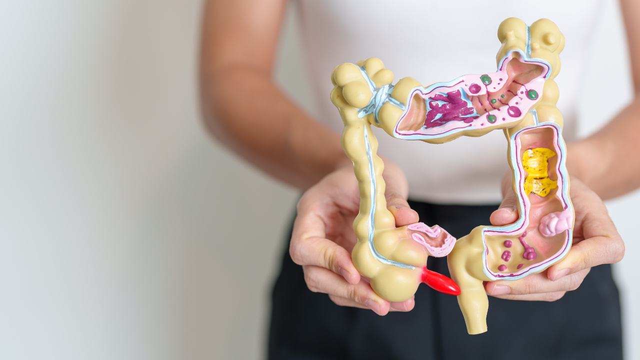 Hội chứng ruột kích thích và viêm đại tràng khác nhau như thế nào?