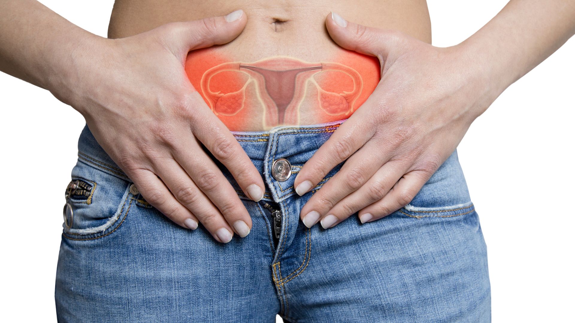 Hội chứng siêu nữ: Nguyên nhân, triệu chứng và hướng điều trị 4