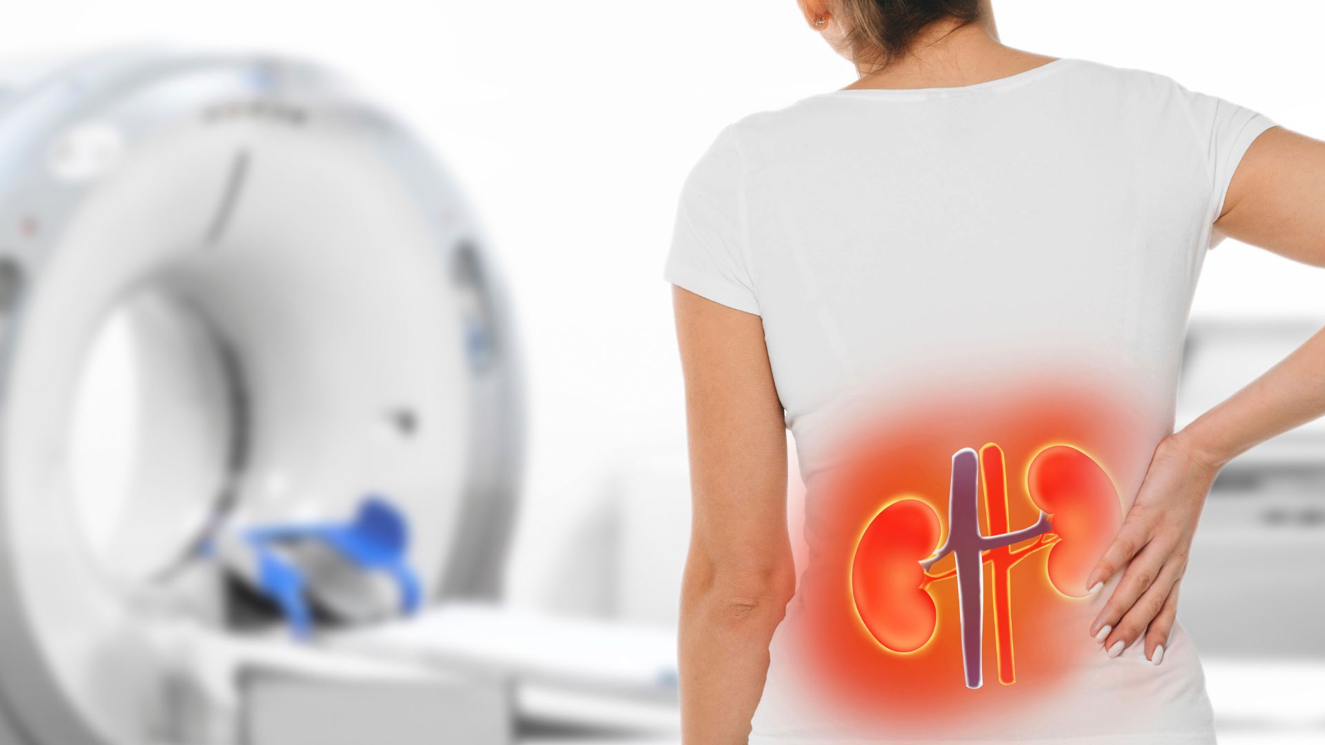 Suy thận mạn là một biến chứng của hội chứng thận hư