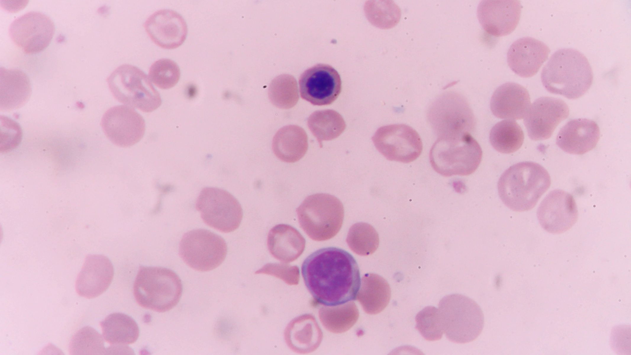 Homocysteine là gì?