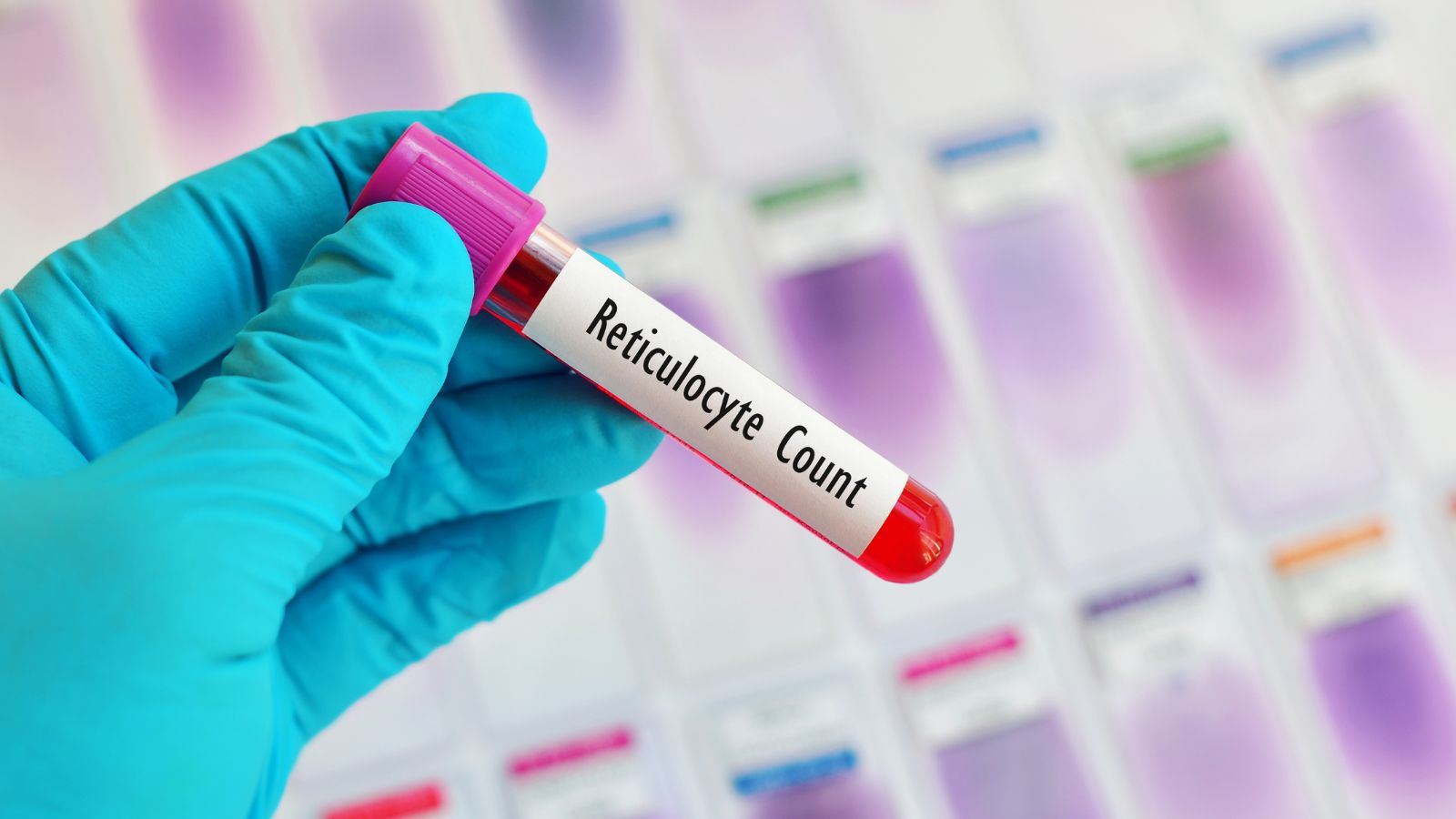 Hồng cầu lưới là những tế bào hồng cầu non