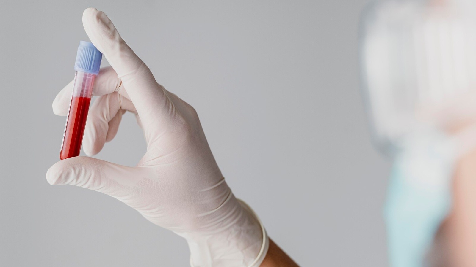 Hồng cầu thấp là tình trạng số lượng hồng cầu trong máu giảm xuống dưới mức bình thường