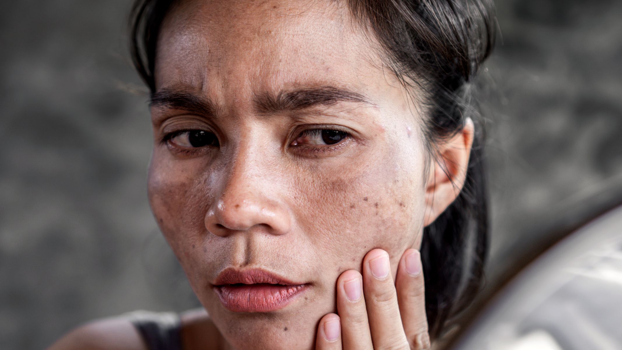 Hormone cortisol và những thông tin cần biết 4