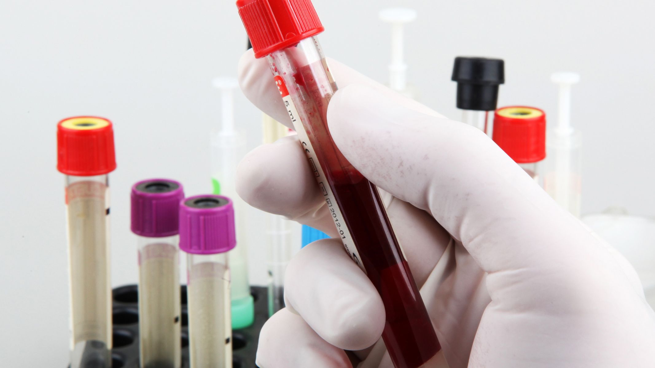 Hormone LH là gì? Những thông tin cần biết 5