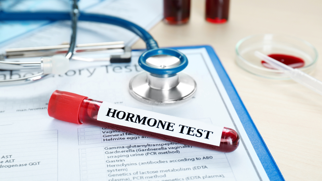 Để đánh giá tình trạng nội tiết, bác sĩ có thể chỉ định một hoặc nhiều xét nghiệm hormone sinh dục