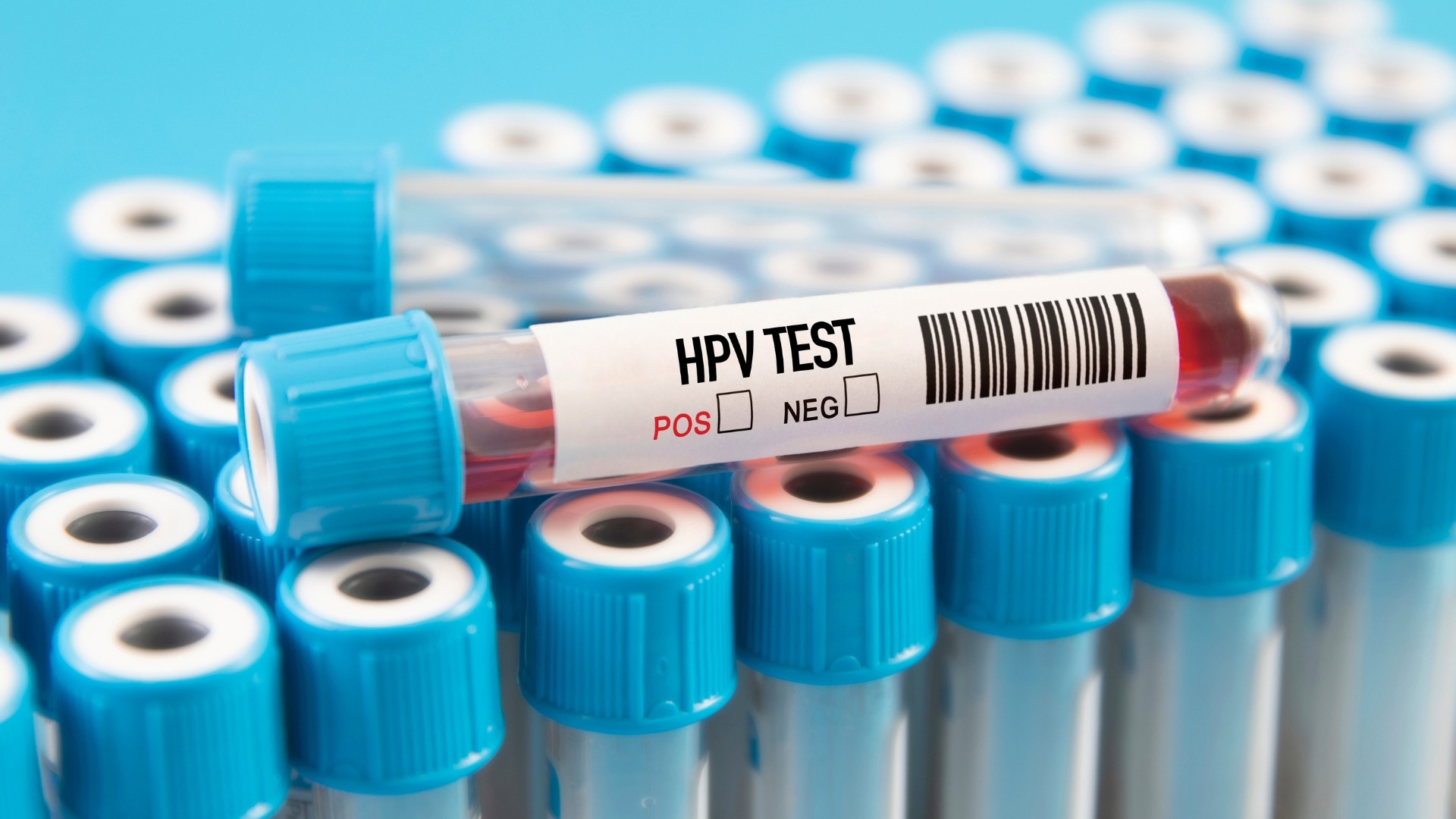 Xét nghiệm HPV DNA giúp phát hiện chính xác virus HPV type 45