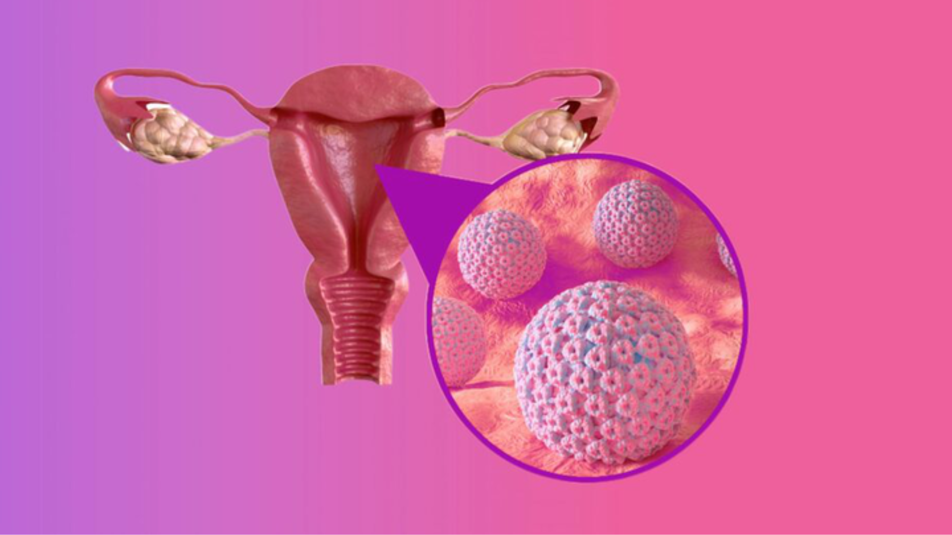 hpv-type-58-nguy-hiem-ra-sao-lam-the-nao-de-phong-ngua-hieu-qua (2).png