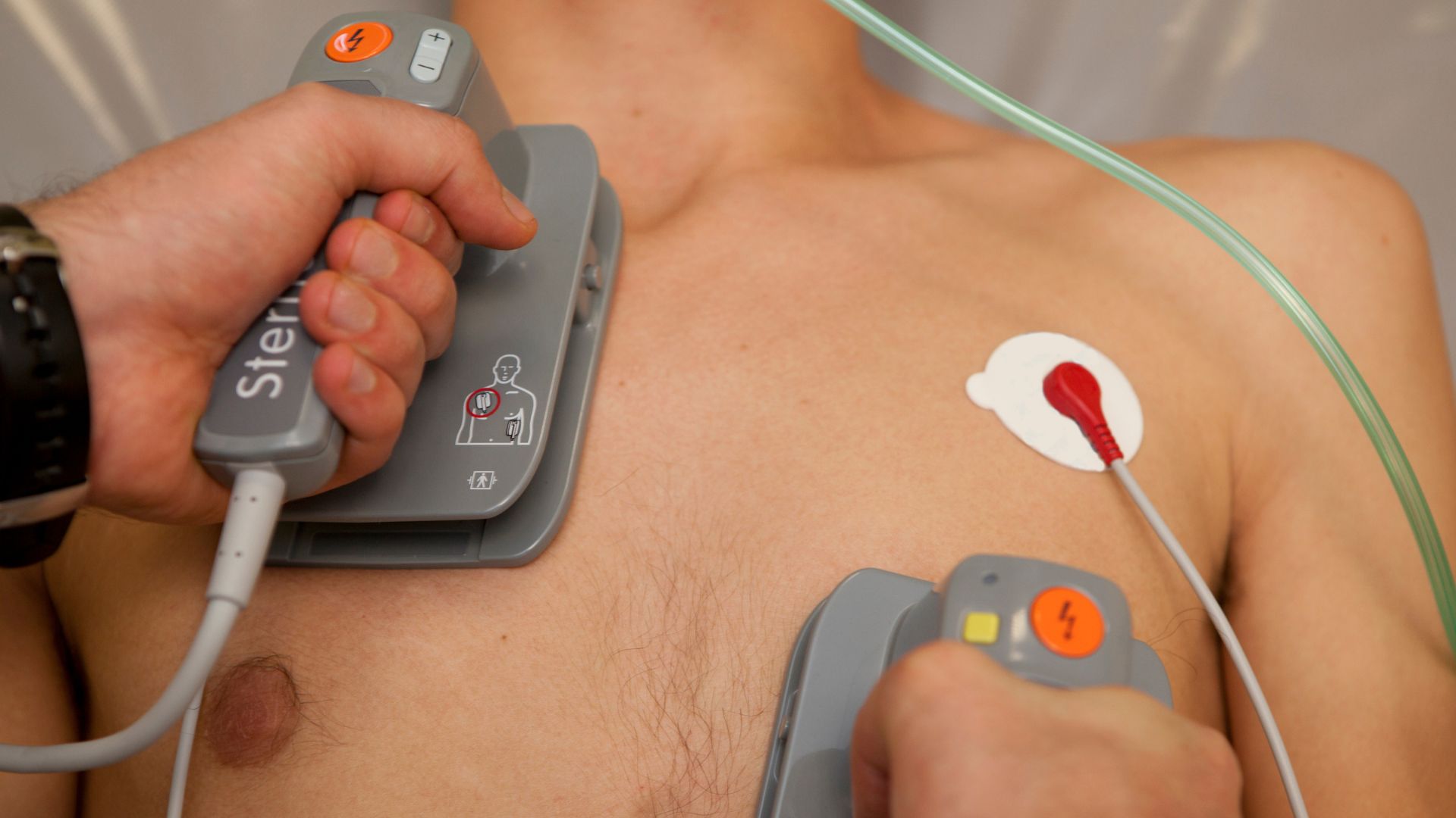 Hướng dẫn cấp cứu sốc phản vệ: Phác đồ chuẩn và phòng ngừa tái phát 1