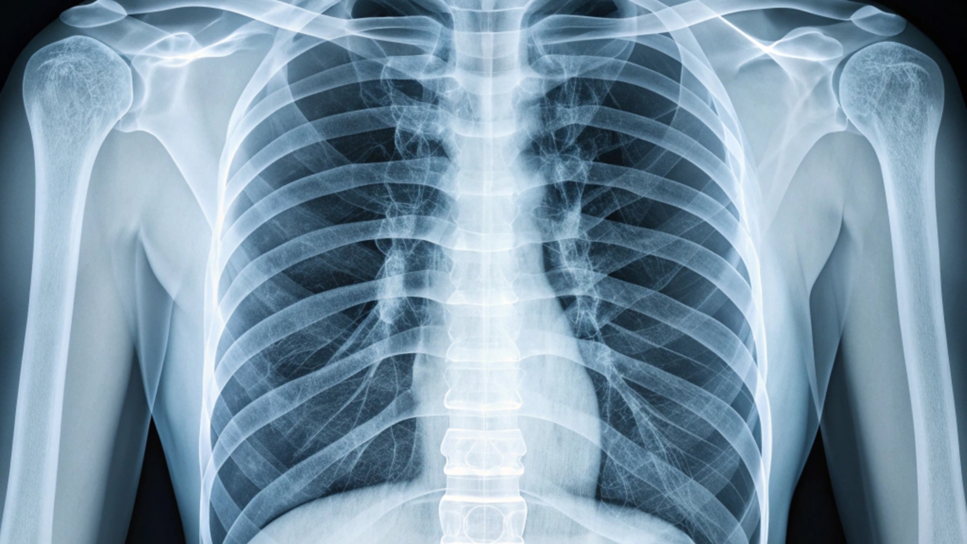 Về chức năng, xương sườn đóng vai trò bảo vệ các cơ quan quan trọng như tim, phổi, gan và lách khỏi những tác động bên ngoài