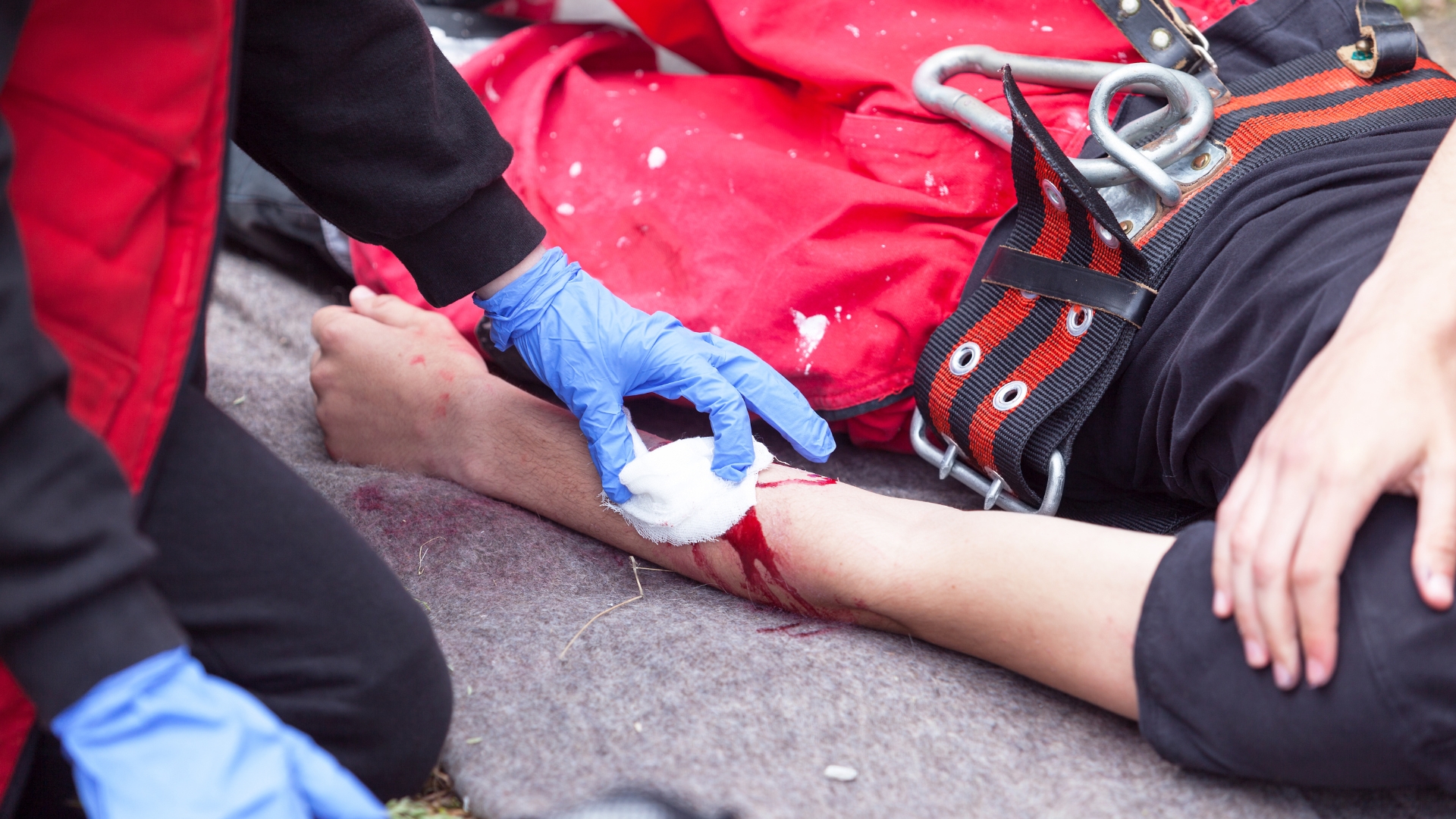 Nếu có vết thương hở, cần cầm máu bằng băng vô trùng, không đè trực tiếp lên đầu xương lòi ra