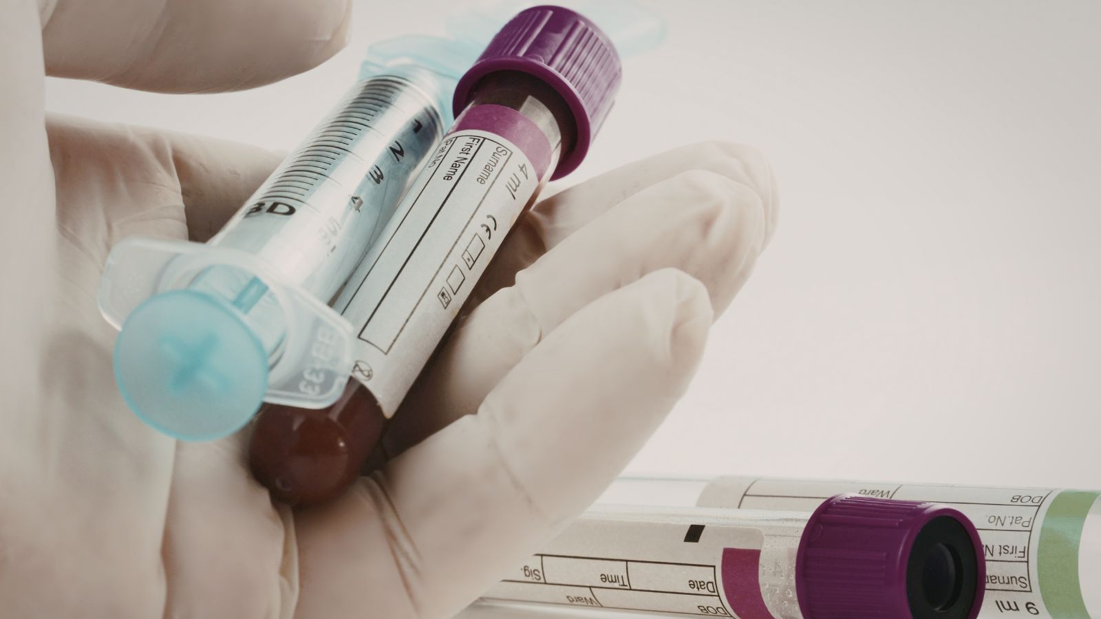 Huyết thanh và huyết tương lại có bản chất, cấu tạo và vai trò khác nhau