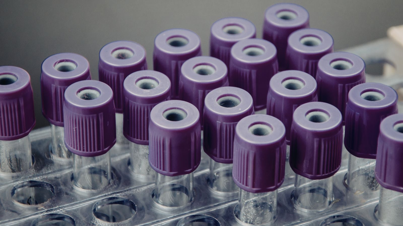 Trong lĩnh vực y học, việc phân biệt rõ huyết thanh và huyết tương có ý nghĩa rất quan trọng.