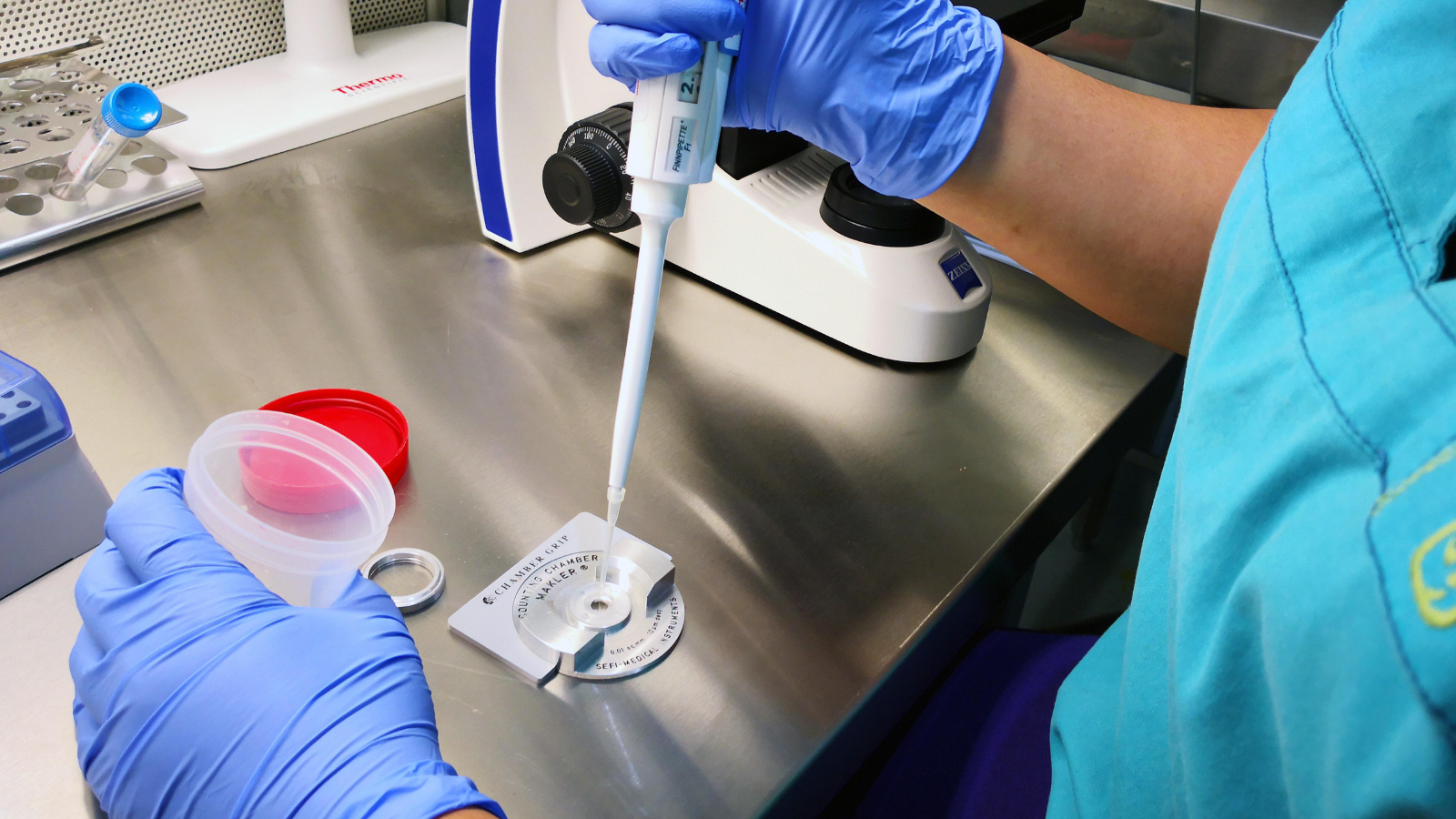 Các chỉ số cơ bản trong kết quả xét nghiệm tinh dịch đồ phản ánh toàn diện chất lượng tinh trùng