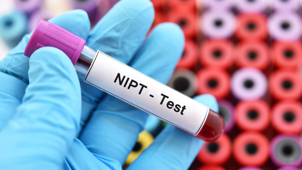 NIPT là xét nghiệm phân tích ADN tự do của thai nhi trong máu mẹ