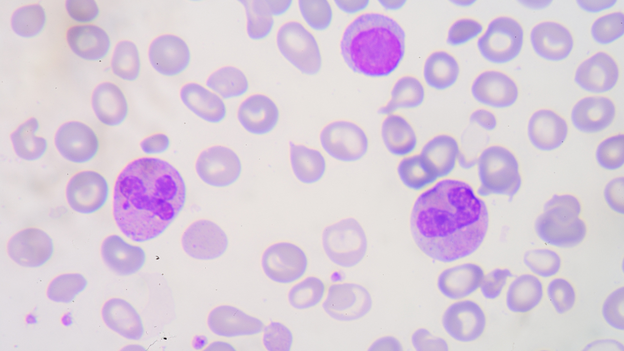 Khám sàng lọc Thalassemia là gì?