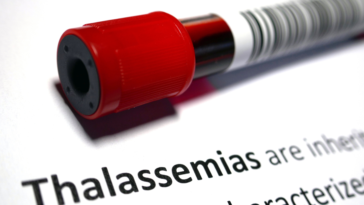 Sàng lọc Thalassemia giúp phát hiện sớm người mang gen bệnh Thalassemia